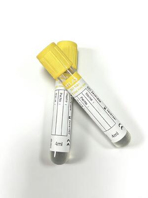 أنابيب فراغ SST: تجلط سريع للمصل وفصل متفوق لمختبرات الأساس