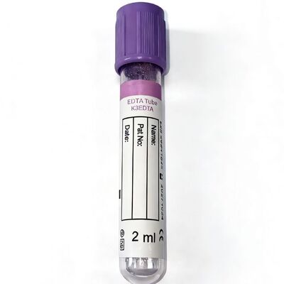 أنابيب EDTA للدم الكامل: ضرورية لتمييز الدم والتحليل الجزيئي